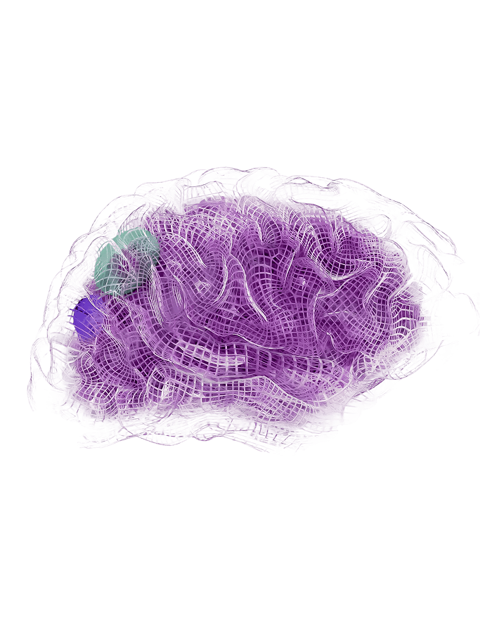AI Brain Healthcare